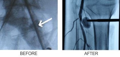 Vascular Trauma