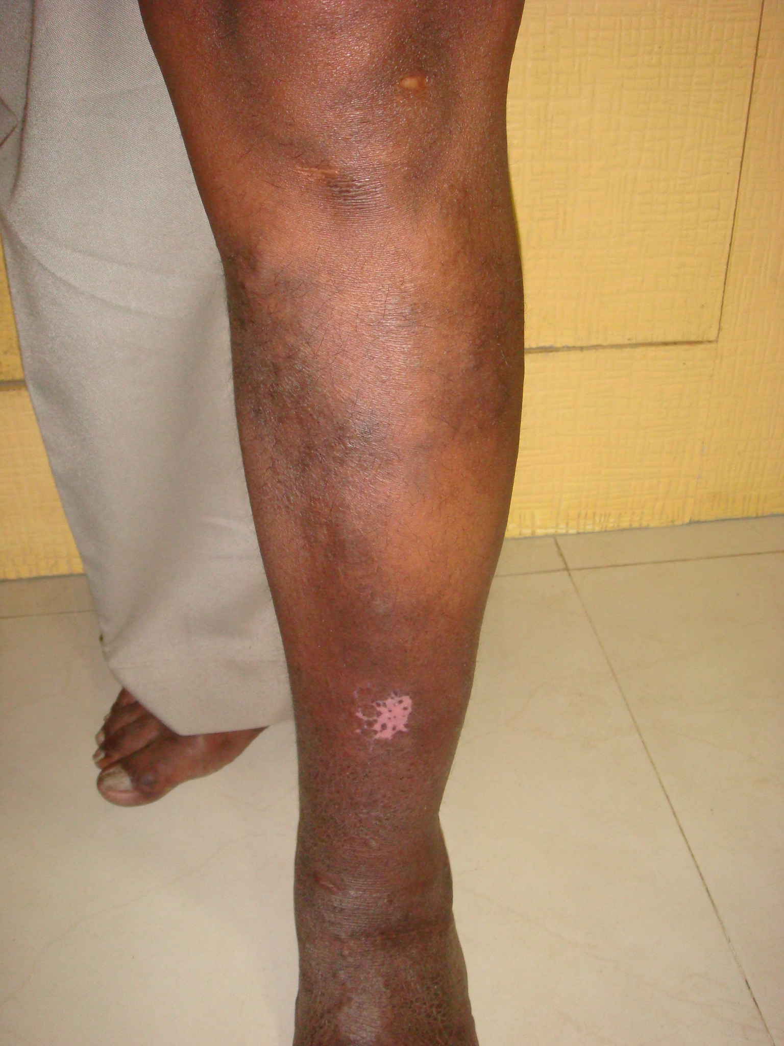 After treatment