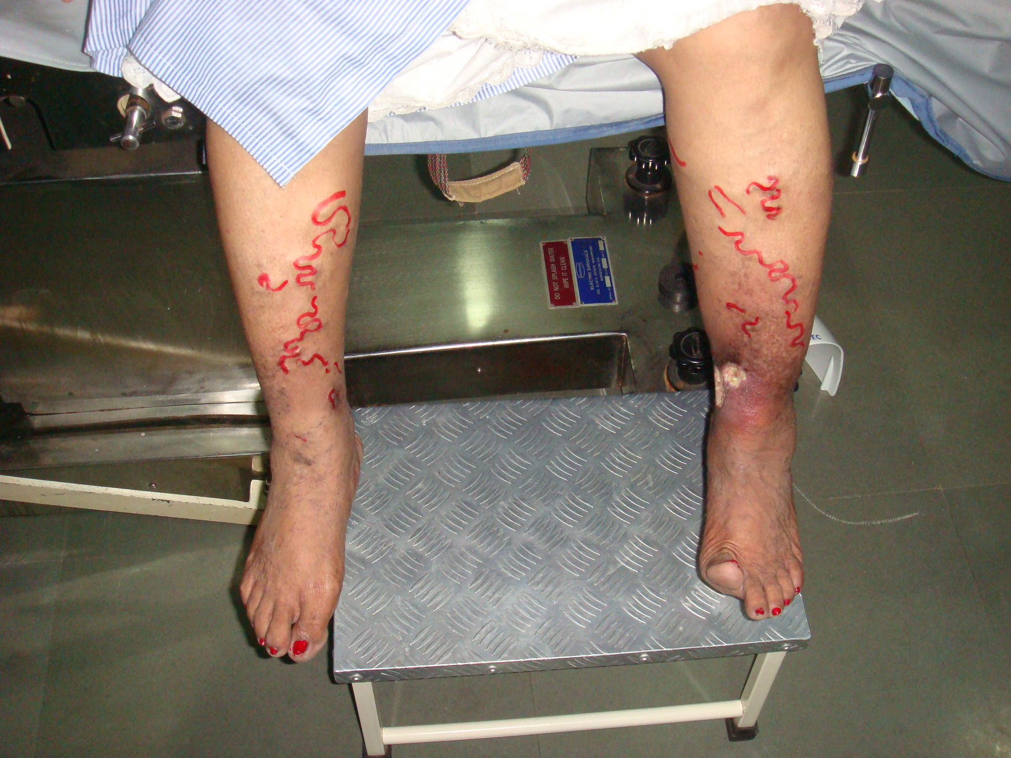 After treatment