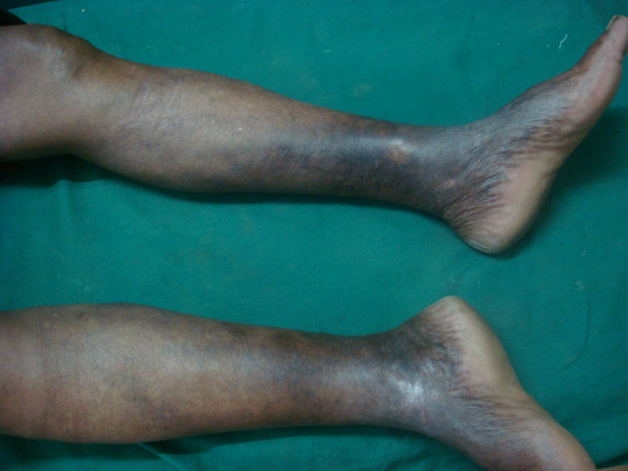 Before treatment