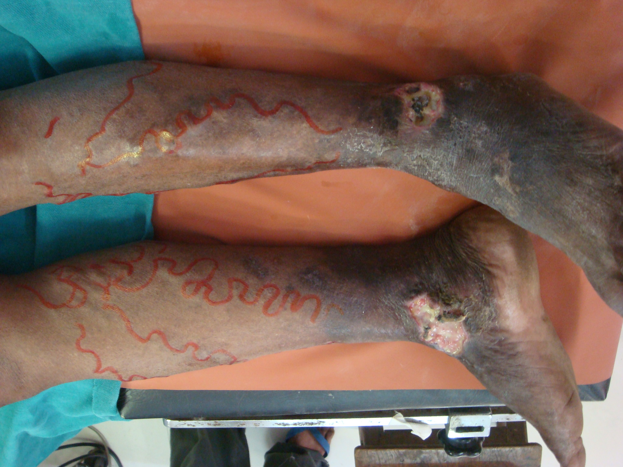 After treatment
