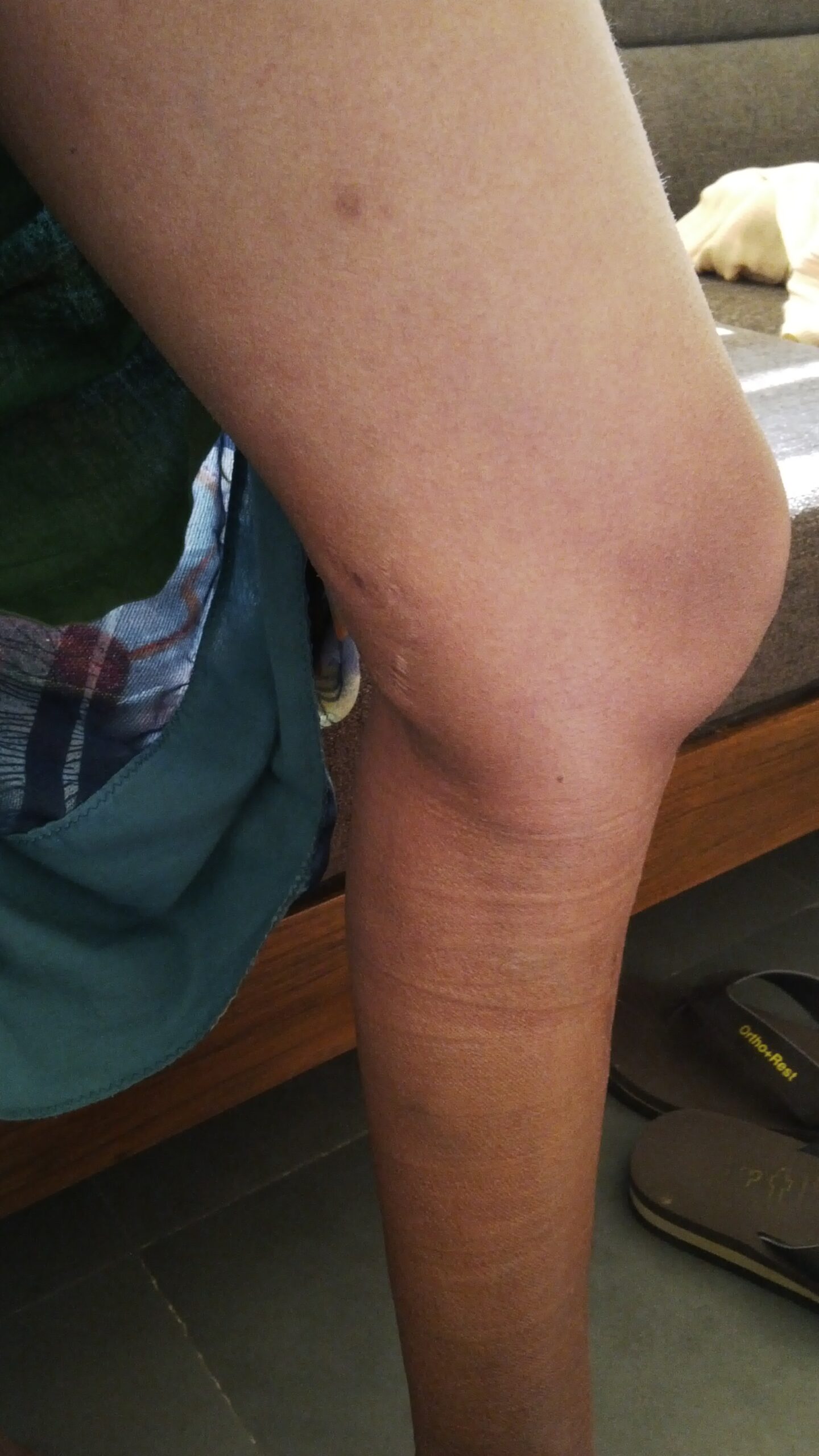 After treatment