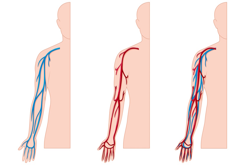 Veins vs. Arteries: What’s the Difference?