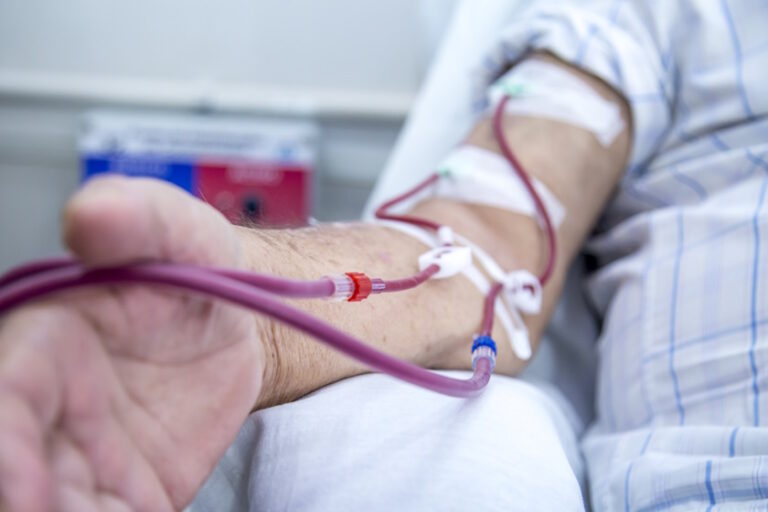 Why an AV fistula is Considered a Lifeline for Dialysis Patients?