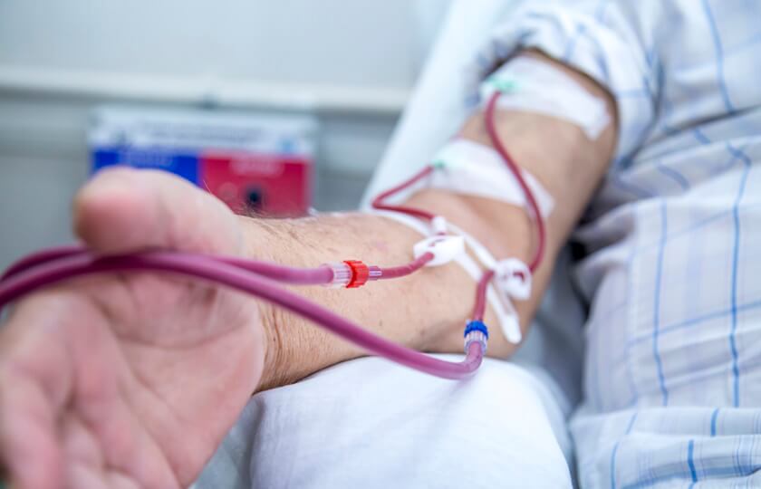 The Role of Vascular Surgeons in Dialysis Patients