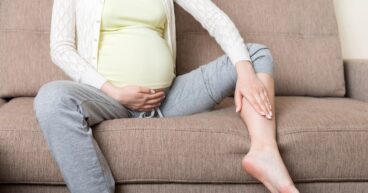 varicose veins with pregnancy