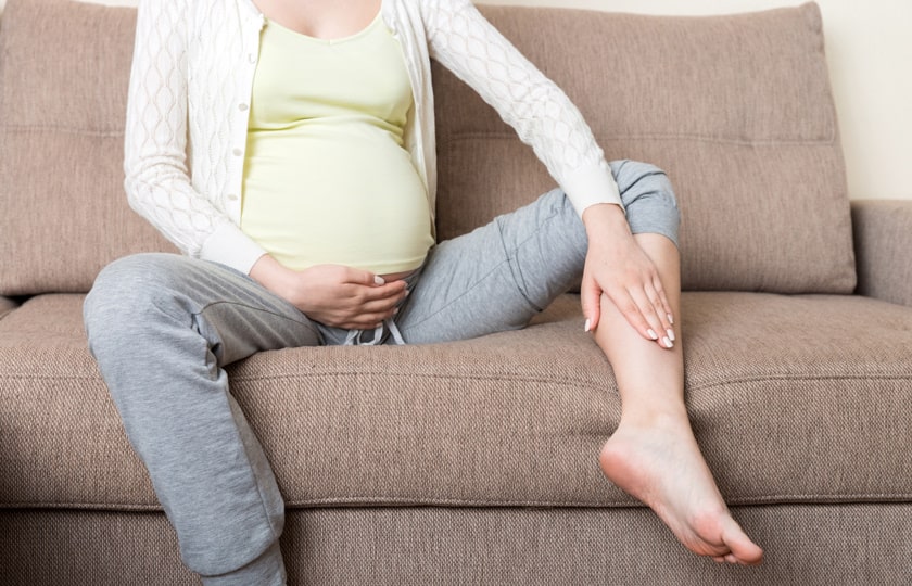 Varicose Veins During Pregnancy – Expert Tips Unleashed