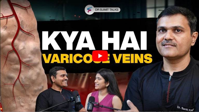 OVERCOME Varicose Veins