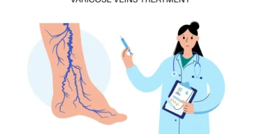 doctor of veins
