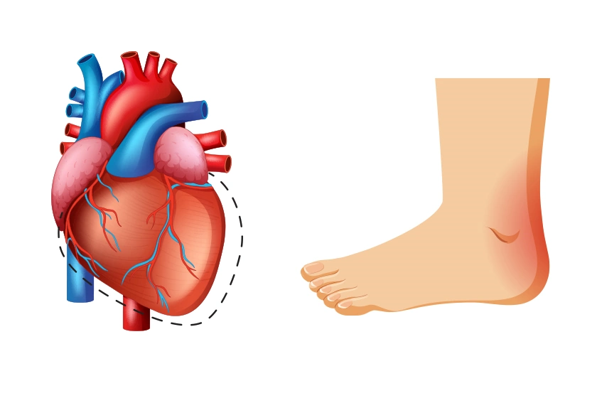 Do Swollen Feet Signal a Problem with the Heart?