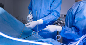 endovascular surgery