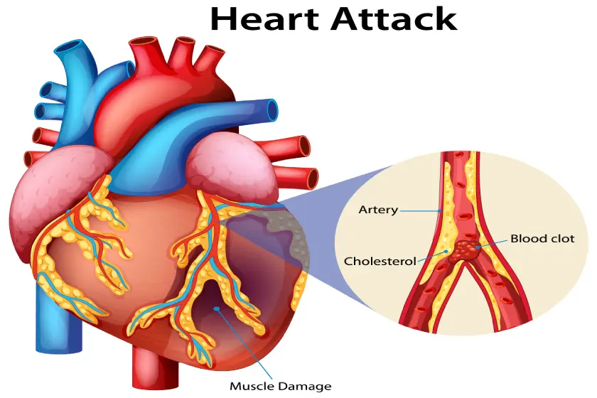 Is Leg Swelling a Sign of Heart, Kidney, or Vein Problems?