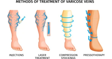 vascular problems in legs
