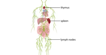 Lymphatic System Disease