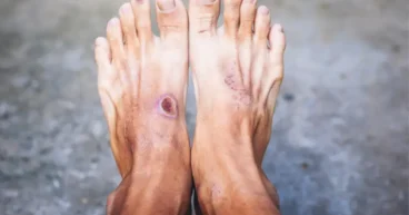 diabetic foot pain
